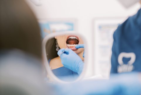 Higiene Oral