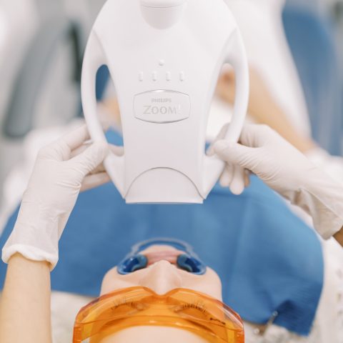 Branqueamento Dentário