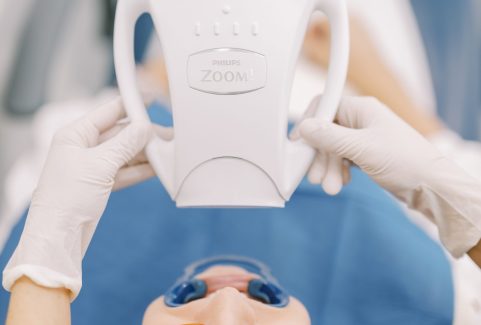 Branqueamento Dentário