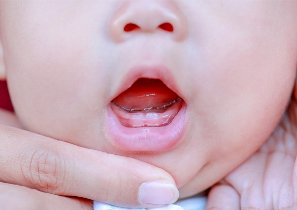 Como cuidar dos Dentes do meu Bebé