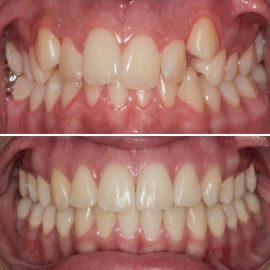 casos clínicos ortodontia