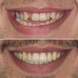 casos clínicos ortodontia