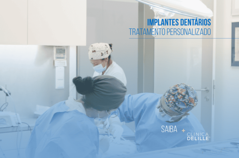 Implantes Dentários: Um tratamento personalizado na Clínica Delille.