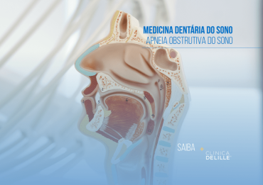 Medicina Dentária do Sono: A apneia obstrutiva do sono