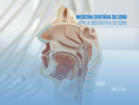 Medicina Dentária do Sono: A apneia obstrutiva do sono