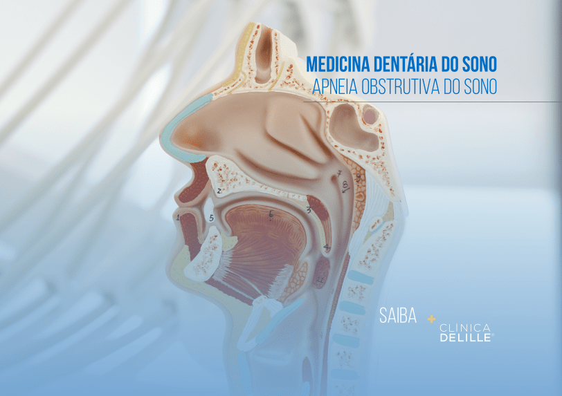Medicina Dentária do Sono: A apneia obstrutiva do sono