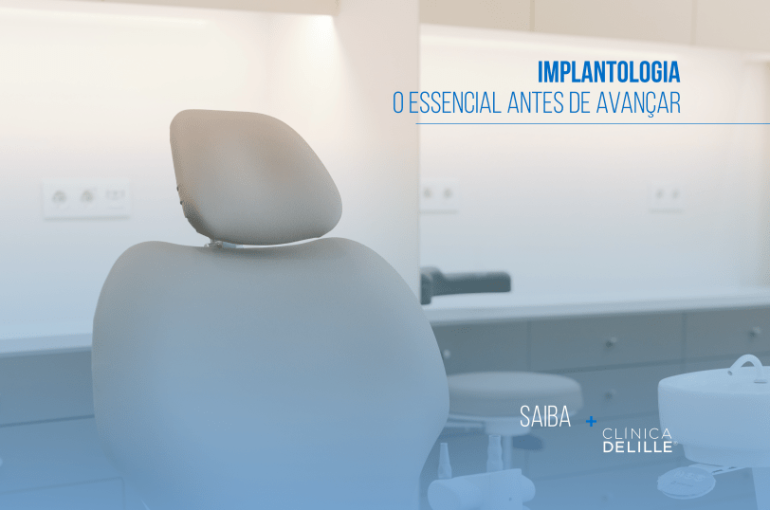 Implantologia: O essencial antes de avançar