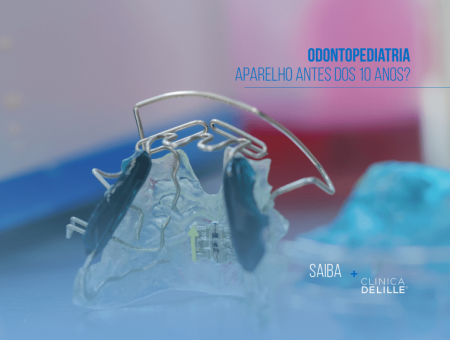 Odontopediatria: Aparelho antes dos 10 anos?
