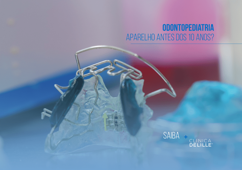 Odontopediatria: Aparelho antes dos 10 anos?