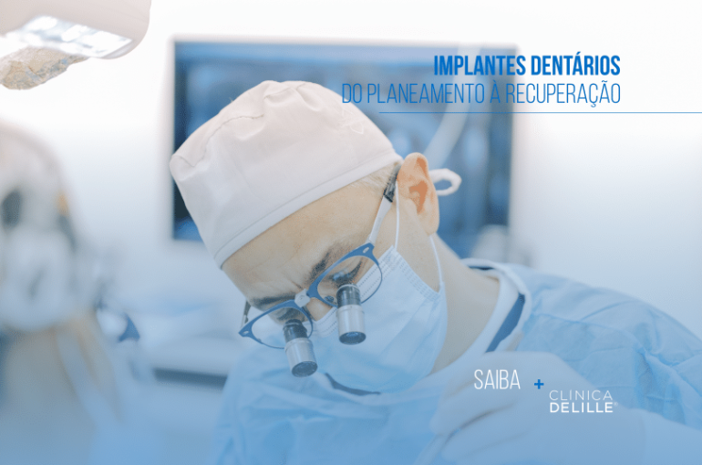 Implantes dentários: Do planeamento à recuperação
